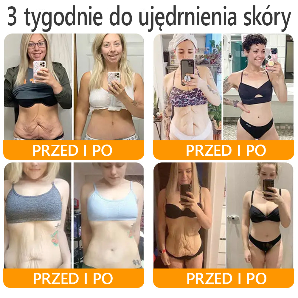 🍯 🎁 Zostało tylko 5 ostatnich pudełek! Przez ograniczony czas, dodatkowe 50% zniżki! Złap szansę na odnowę swojej skóry ✨Jeśli przegapisz teraz, nie będziesz mieć okazji do przyszłego roku!