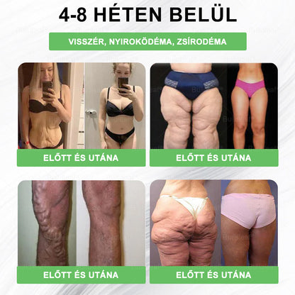 💚 🎁 Már csak 10 doboz maradt! Korlátozott ideig érvényes ajánlat, extra 50% kedvezmény! Ragadd meg ezt a lehetőséget, hogy karcsúbb, energikusabb életet élj. Ha lemaradsz, jövő évig kell várnod!