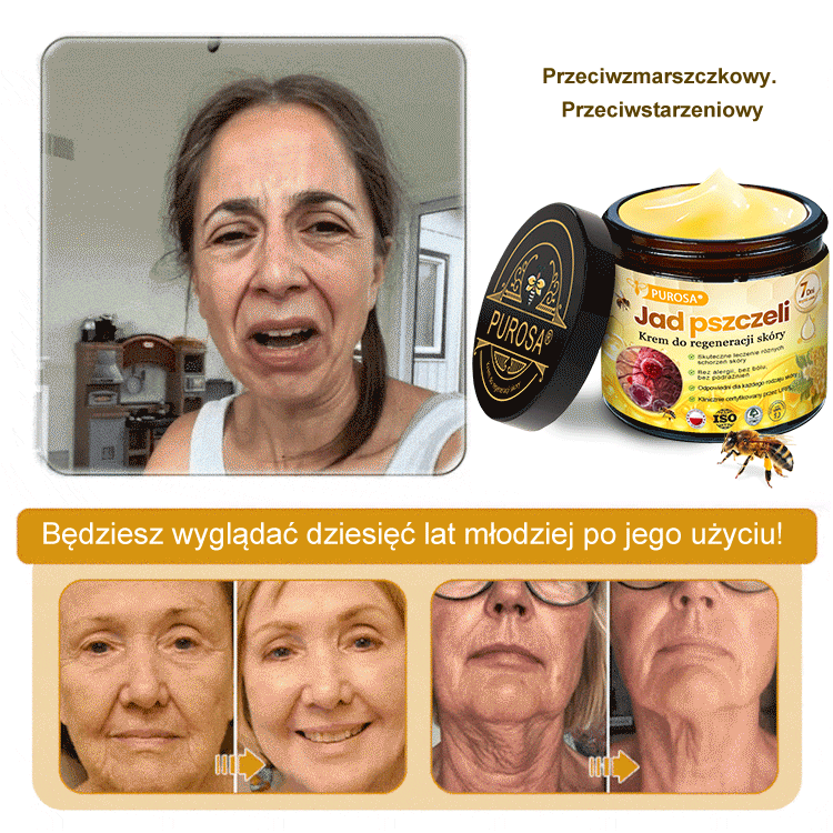 🍯 🎁 Zostało tylko 5 ostatnich pudełek! Przez ograniczony czas, dodatkowe 50% zniżki! Złap szansę na odnowę swojej skóry ✨Jeśli przegapisz teraz, nie będziesz mieć okazji do przyszłego roku!