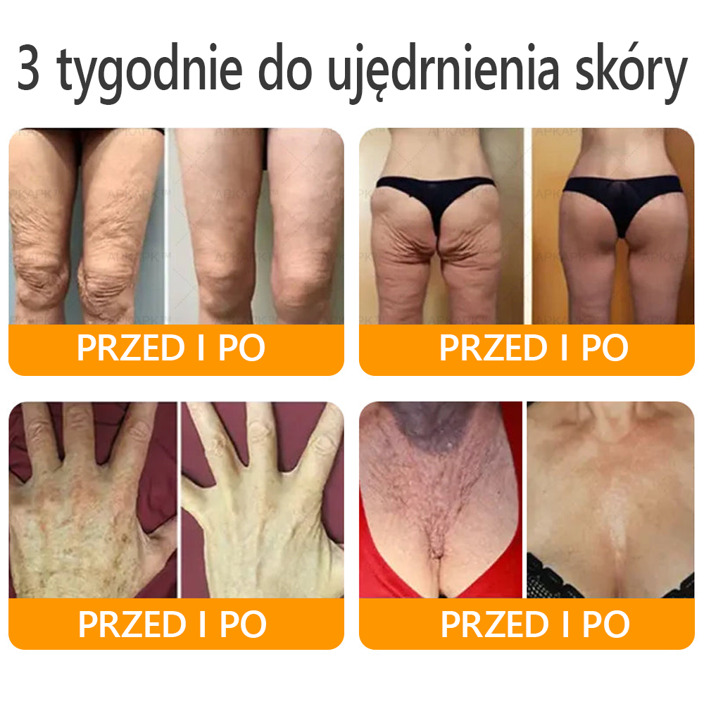 🍯 🎁 Zostało tylko 5 ostatnich pudełek! Przez ograniczony czas, dodatkowe 50% zniżki! Złap szansę na odnowę swojej skóry ✨Jeśli przegapisz teraz, nie będziesz mieć okazji do przyszłego roku!