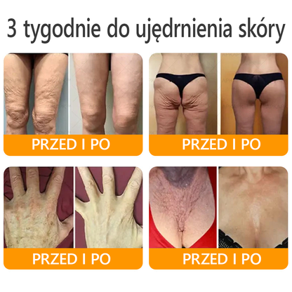 🍯 🎁 Zostało tylko 5 ostatnich pudełek! Przez ograniczony czas, dodatkowe 50% zniżki! Złap szansę na odnowę swojej skóry ✨Jeśli przegapisz teraz, nie będziesz mieć okazji do przyszłego roku!